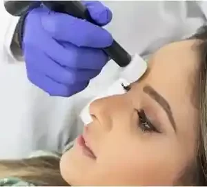 Micro-Channeling - Face Only (3 Prepaid Sessions)