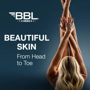 Radiant and Youthful Skin with BBL HERO - Face Only